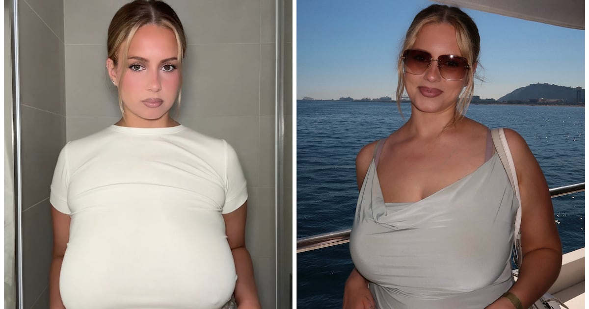 Woman Gets Life-Changing Breast Reduction From Size ’36G to 36C’