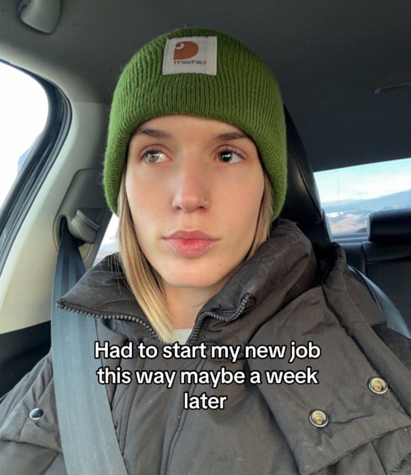 Roughly a week after the accident Sarah Bell had to start a new job with her injured eye.