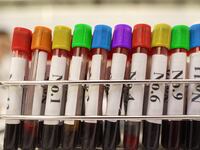 articles/2014/11/22/the-outrageous-celibacy-requirement-for-gay-blood-donors/141121-michaelson-gay-blood-tease_pdw6wu