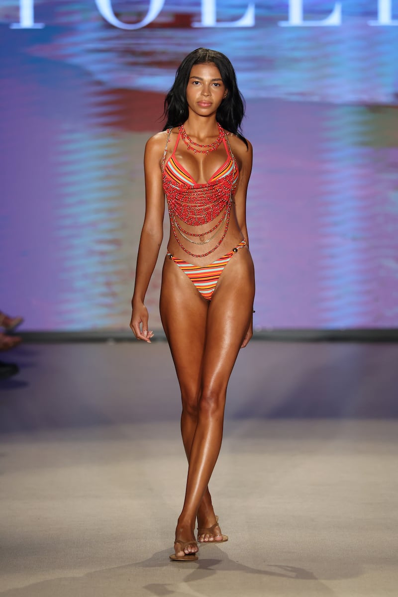 The model says she regrets accepting free plastic surgery offers.