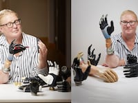 Karin showcases her bionic hand