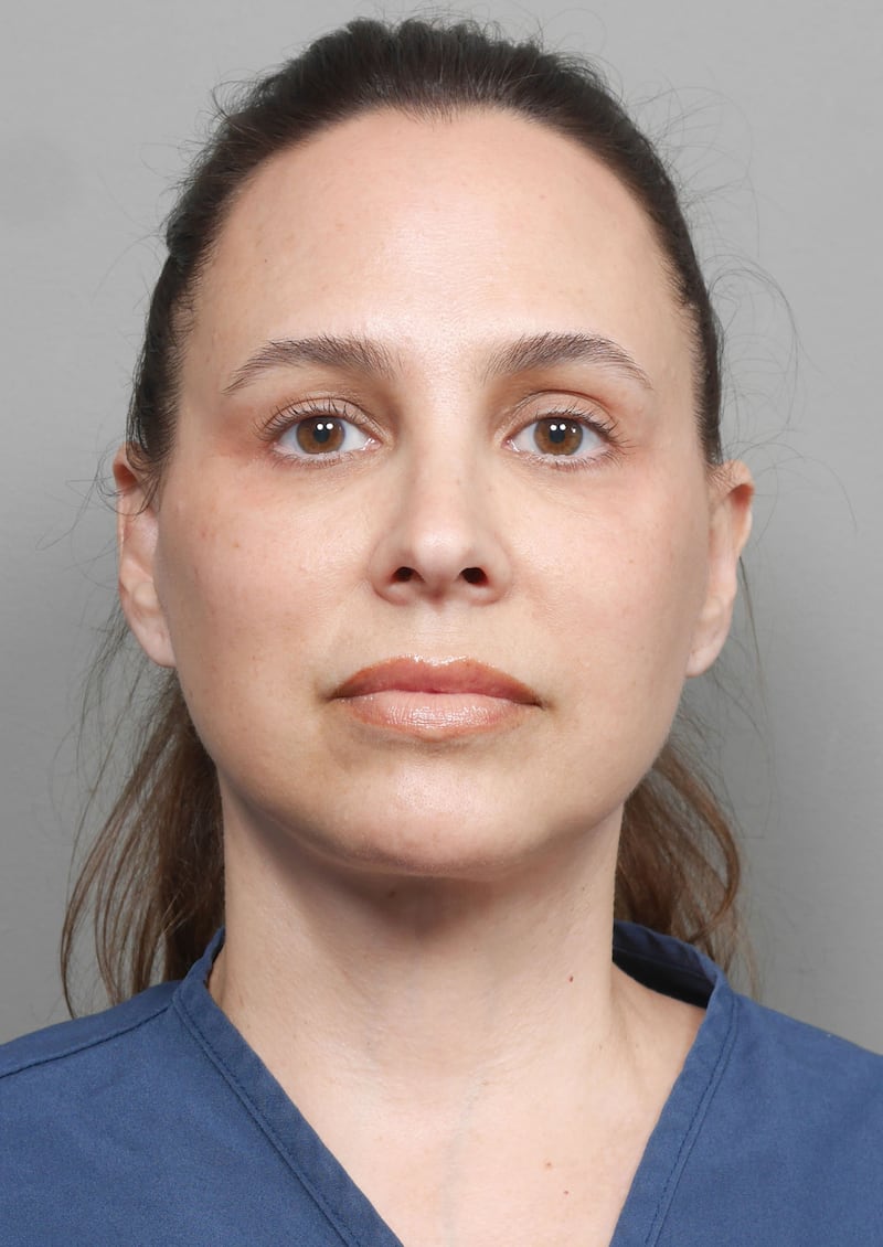 After losing 80 pounds on GLP-1s, Leah’s ears lost some of their volume. During her facelift appointment, Dr. Daniel Gould transferred fat to her earlobes.