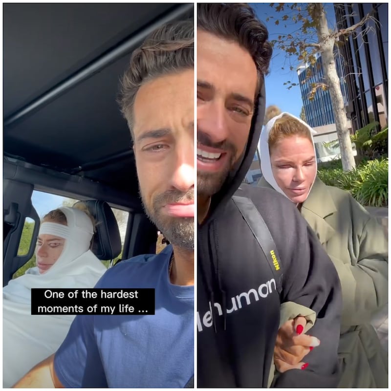 In 2024, Caroline Stanbury's husband, Sergio Carrallo, documented her facelift on Instagram.