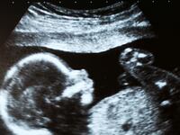 articles/2017/01/27/how-ultrasounds-inspired-abortion-s-enemies/170125-Lewis-ultrasounds-abortion-right-tease_azazud