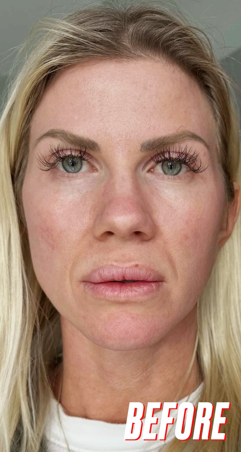 Looker - A 20-Minute Treatment Completely Transformed This Woman's Skin