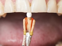 articles/2016/03/13/bye-bye-brushing-nanoparticles-are-coming-to-save-your-teeth/160312-ossola-teeth-tease_sollfd