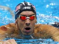 articles/2016/08/08/those-bruises-on-olympians-are-from-cupping-but-what-is-cupping/160808-slattery-cupping-tease_mpcjre
