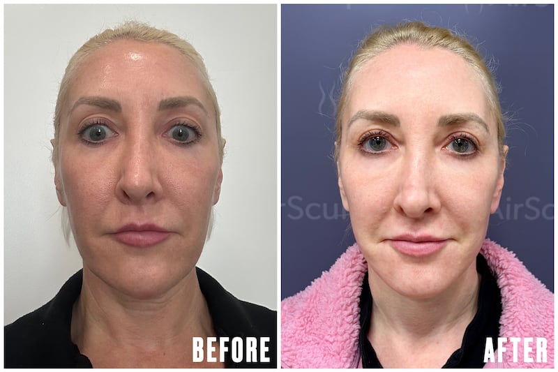 The Looker - Why This Cosmetic Surgeon Got a Facelift at 45