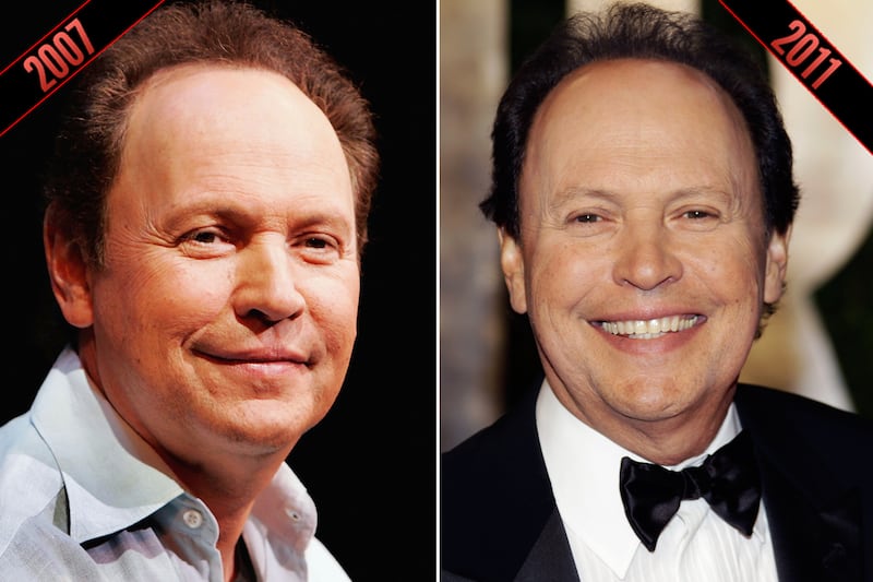 galleries/2011/10/05/simon-cowell-steve-martin-male-stars-rumored-plastic-surgery-photos/plastic-surgery-billy-crystal-2_k3gyn5