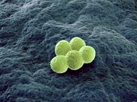 articles/2014/06/21/the-fake-superbug-cure/140620-sepkowitz-superbugs-tease_buji5t