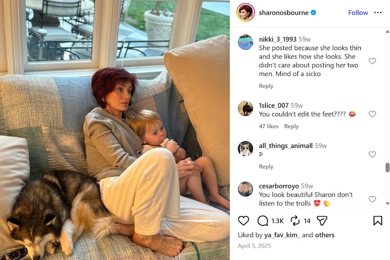 Online users diagnosed Sharon Osbourne with "Ozempic feet" after she put her feet on display in an Instagram post.