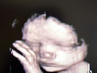 articles/2012/06/08/new-finding-that-testing-could-identify-defects-in-fetuses-is-a-genetics-baby-step/fetus-ultrasound-sepkowitz_oavrym