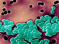 articles/2014/05/01/antibiotic-resistance-is-everyone-s-problem/140501-resistant-antibiotics-tease_uxgbtx