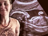 190722-weil-midwife-miscarrige-tease_g0xx7v