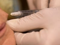 A cosmetic procedure