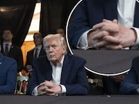 Donald Trump with inset of his hands