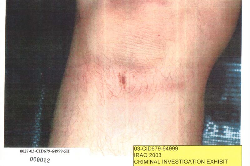 articles/2016/02/05/obama-s-pentagon-covers-up-bush-era-detainee-abuse/160205-shane-abuse-embed3_k5pxen
