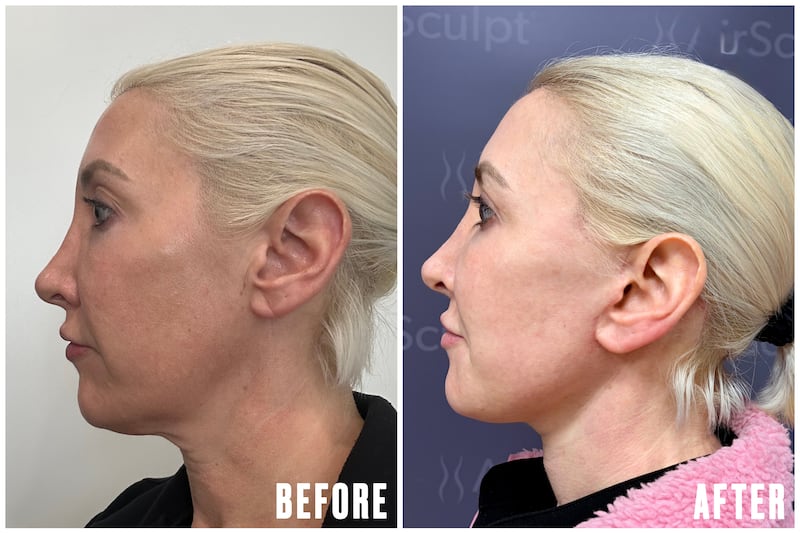 The Looker - Why This Cosmetic Surgeon Got a Facelift at 45