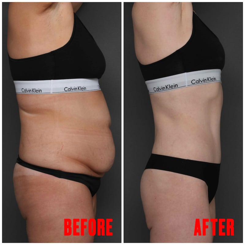 Body Transformation before and after images
