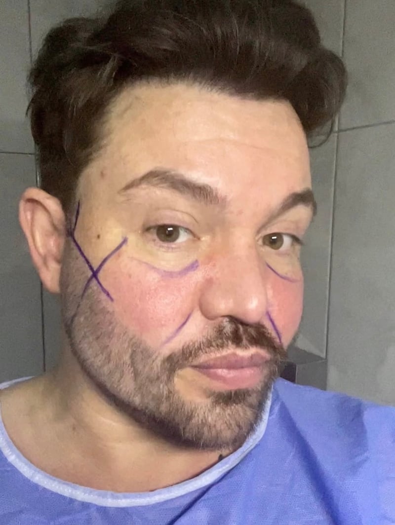Bobby Norris posted behind-the-scenes material of his operation on Instagram.