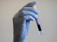 2020-06-05T142143Z_198847271_RC223H9CM3FV_RTRMADP_3_HEALTH-CORONAVIRUS-BRITAIN-NHS_gujshx