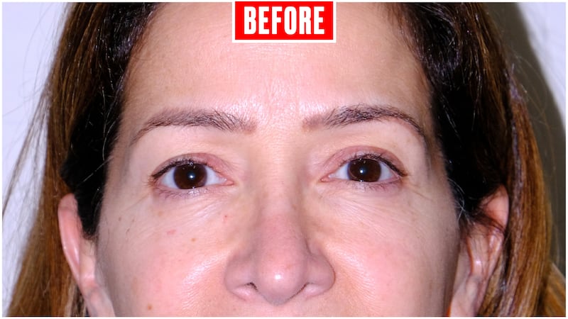 Eyebrow Tranformation