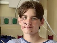 Wyatt Kauffman, 14, survived falling almost 100 feet off a cliff at the Grand Canyon in Arizona.