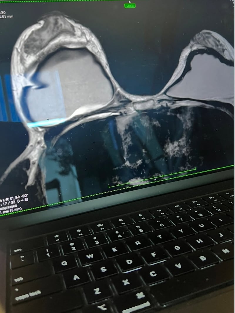In her Instagram post, Jennifer Sterger shared an X-ray photo of her breasts.