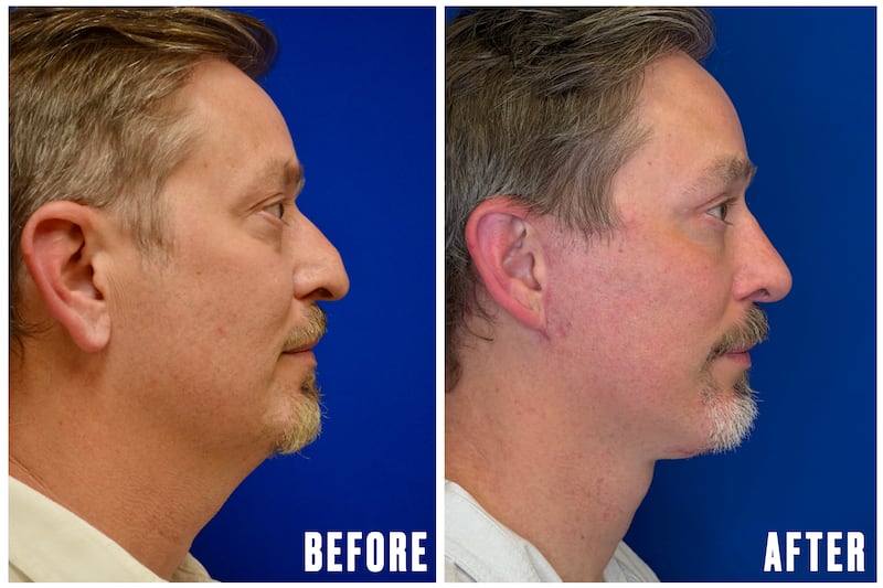 Why This Office Wardrobe Staple Is Driving Men to Get Plastic Surgery for The Looker