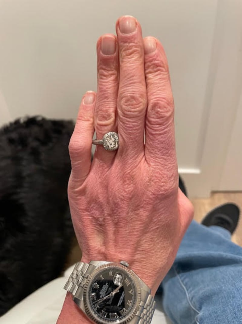 Jill's hands before the procedure.