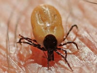articles/2015/05/28/why-lyme-disease-cases-are-spiking/150427-dailyburn-lyme-tease_lgn8qy