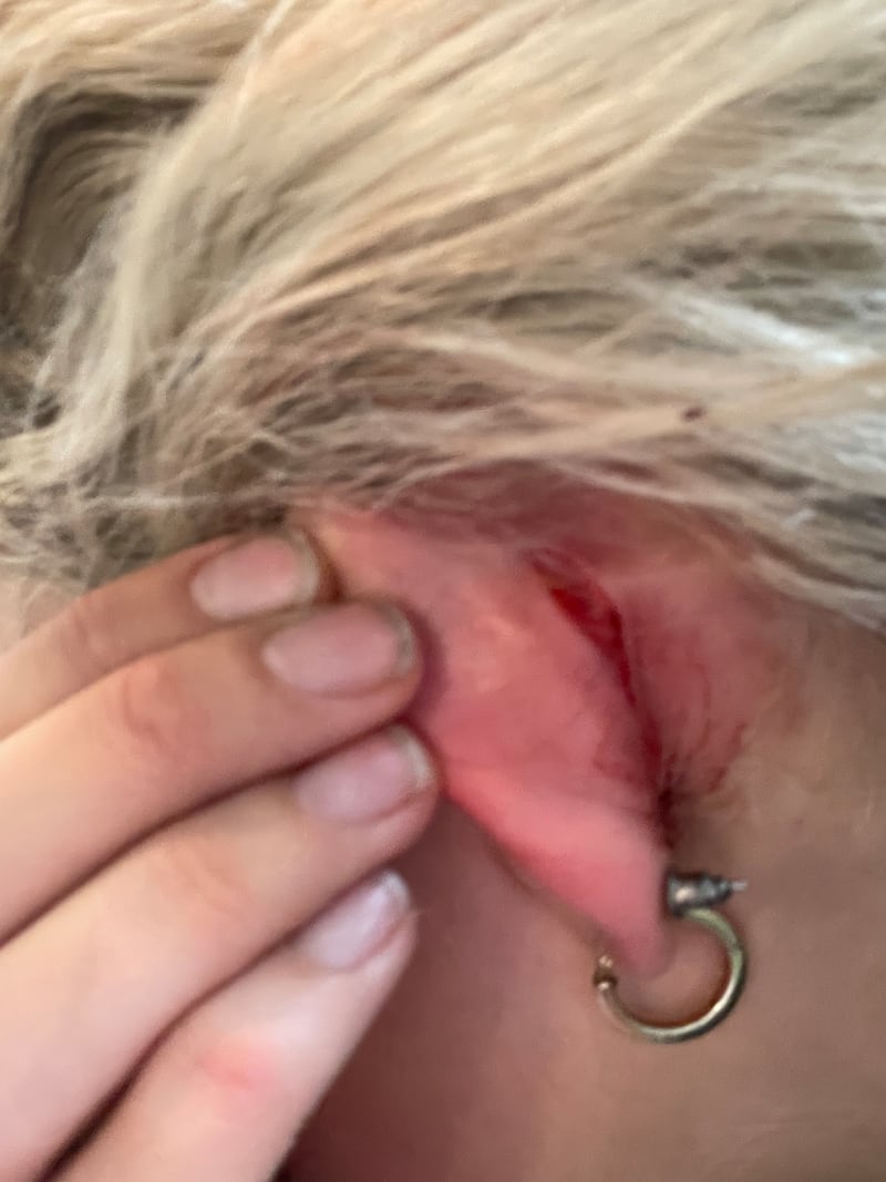 A photo of Grace Jabbari's injuries after March 2023 incident.