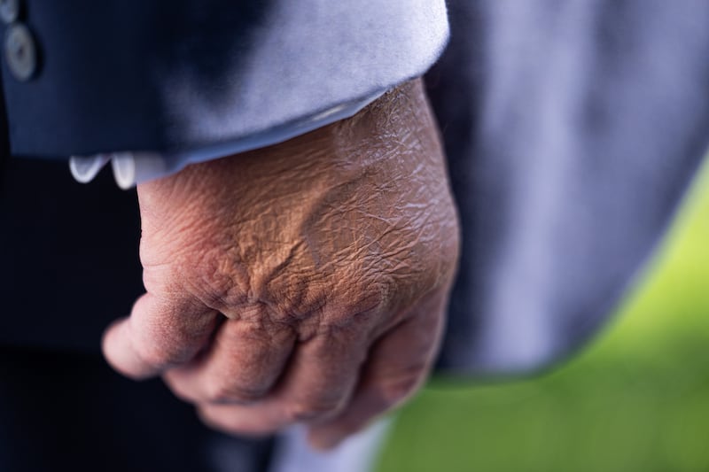 President Donald Trump's right hand is visible as he speaks to the media on the South Lawn before departing the White House on October 22, 2026 in Washington, DC.