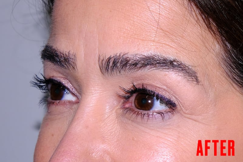 Eyebrow Tranformation