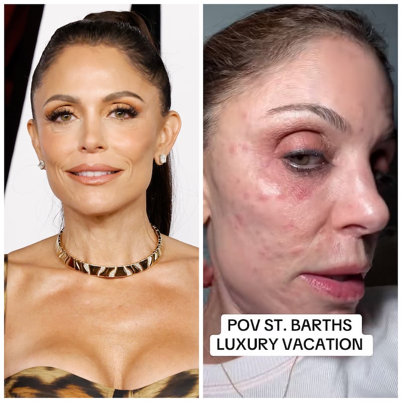 Bethenny Frankel