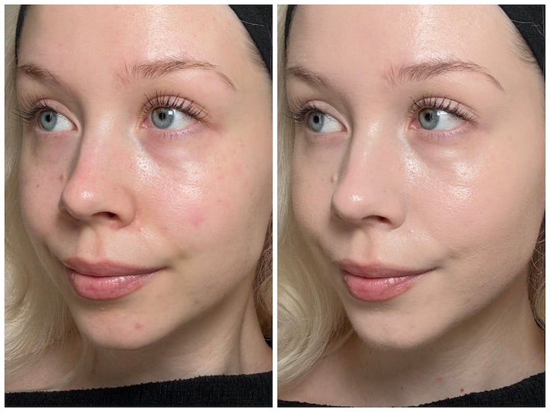 Before and after applying the Smashbox Dual Filter 2-in-1 Concealer + Foundation.
