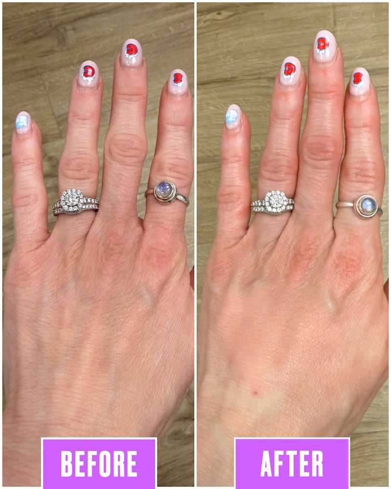 Hand Injection Before and After