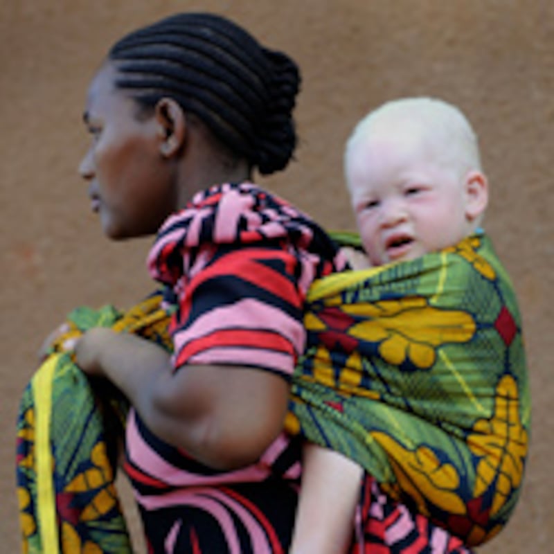 articles/2010/08/27/juju-chang-albino-crimes-seeing-improvement-in-africa/chang-albino-murders_122696_zsxvi4