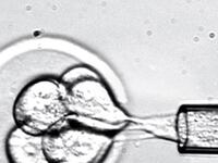 articles/2011/05/16/embryonic-stem-cell-therapy-are-we-on-the-brink-of-results/begley-stem-cells_180575_zoqtx3