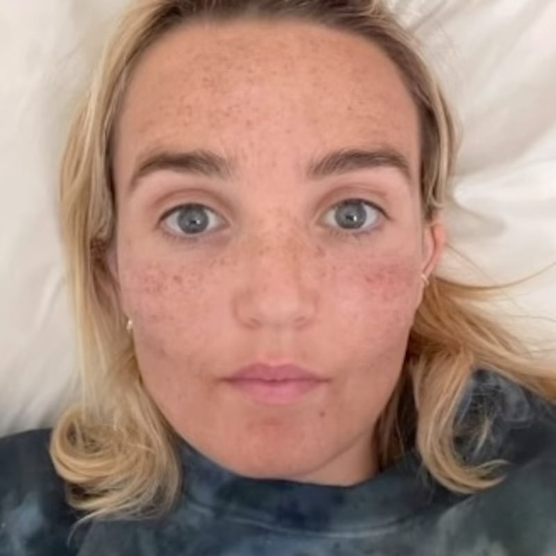 'Saturday Night Live' star Chloe Fineman posts photos from her 'Botched' album of her selfies after skincare treatments.