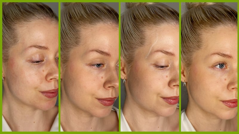 Before and After of Roosa Rahkonen using makeup to conceal veins.