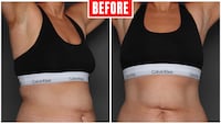 Body Transformation before images