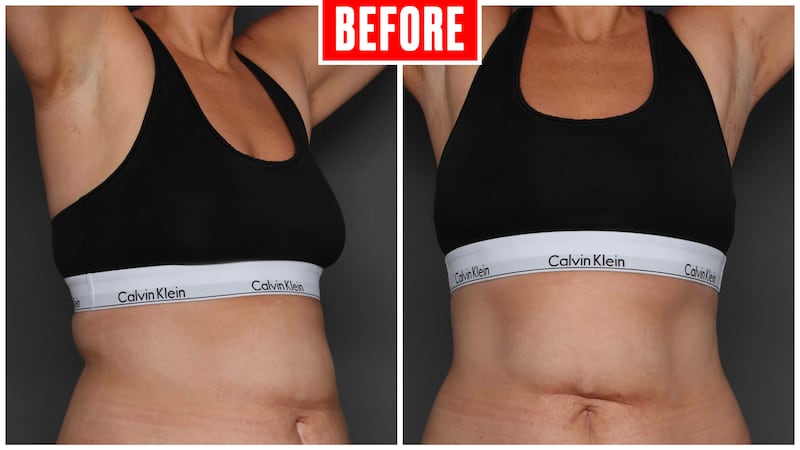 Body Transformation before images