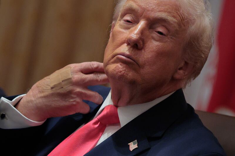 WASHINGTON, DC - DECEMBER 02: U.S. President Donald Trump wears adhesive bandages on the back of his hand during a meeting of his cabinet in the Cabinet Room of the White House on December 02, 2025 in Washington, DC. A bipartisan Congressional investigation has begun about Defense Secretary Pete Hegseth's role in ordering U.S. military strikes on small boats that have killed scores of people in the waters off Venezuela, which Hegseth said are intended "to stop lethal drugs, destroy narco-boats and kill the narco-terrorists who are poisoning the American people.” (Photo by Chip Somodevilla/Getty Images)