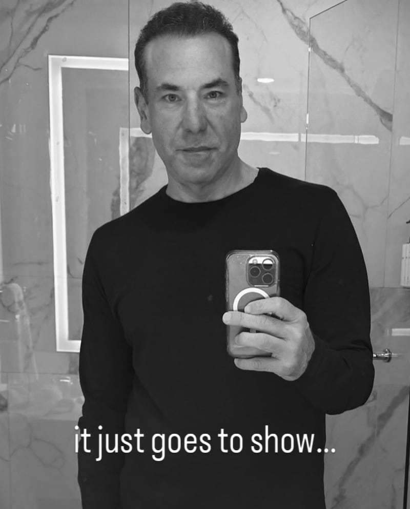 Rick Hoffman first showed his hair transformation in a June 3 Instagram post. He wrote on the photo, “It goes to show.” His former ”Jake in Progress” co-star John Stamos joked in the comments, “What, that you’re wearing a wig?”