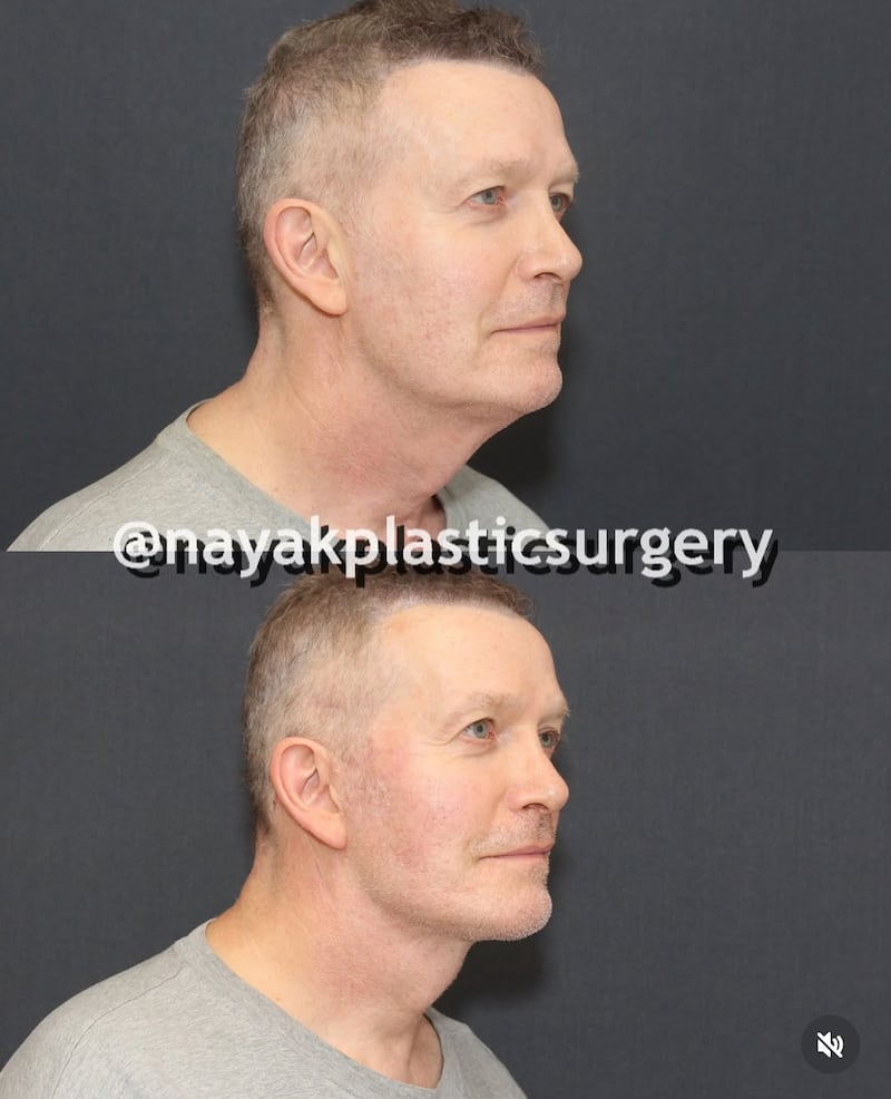 John Spaedy before-and-after photos.