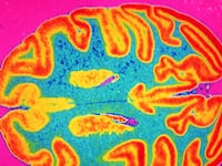articles/2015/10/11/my-cancer-is-as-strange-as-my-fiction/151010-barnes-cancer-tease_jljtrq