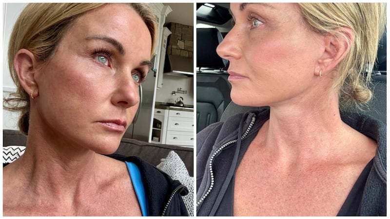 Chari Pack was pleased with her natural results, which did not change any of her features but helped her recognize the person she saw in the mirror again.