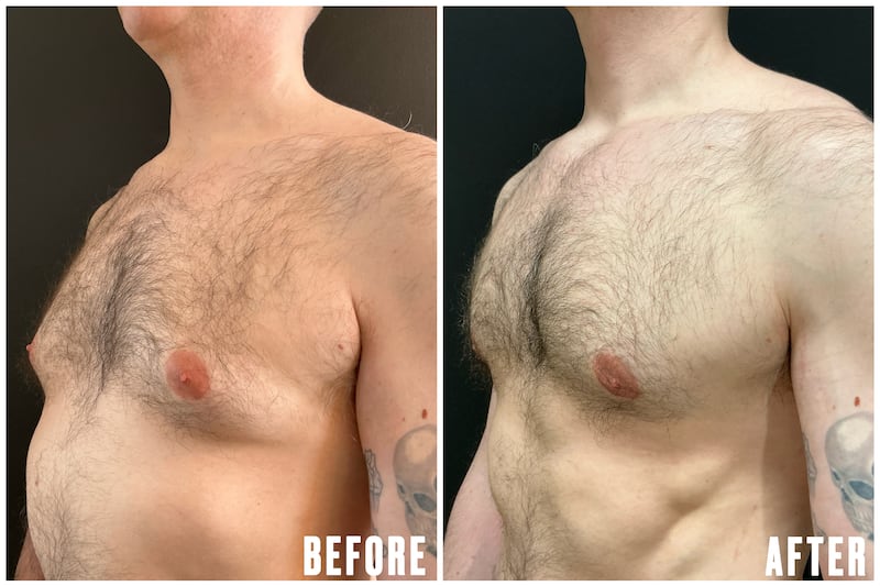 The Looker illo illustration for - This Plastic Surgery Gave Him The Confidence to Change Jobs