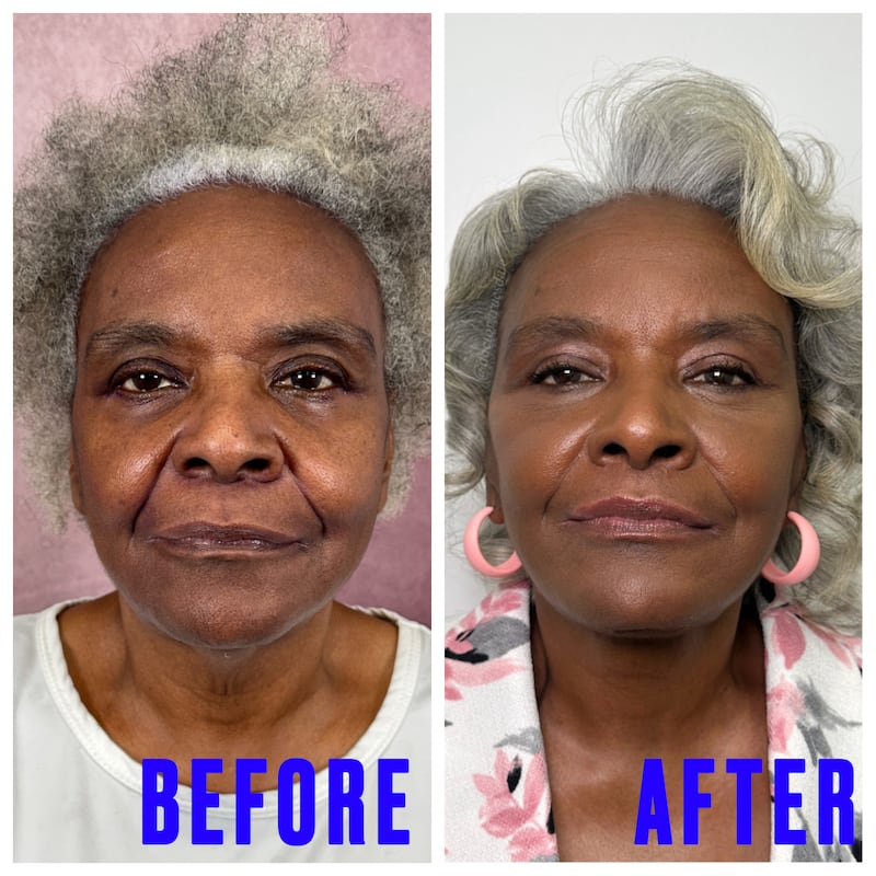 For The Looker - This Surgeon Gave His Mother a Facelift and the Results Went Viral
